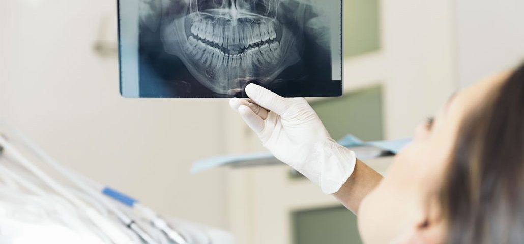dentist taking x ray